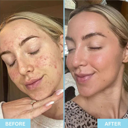 Glow Sea Moss Gummies